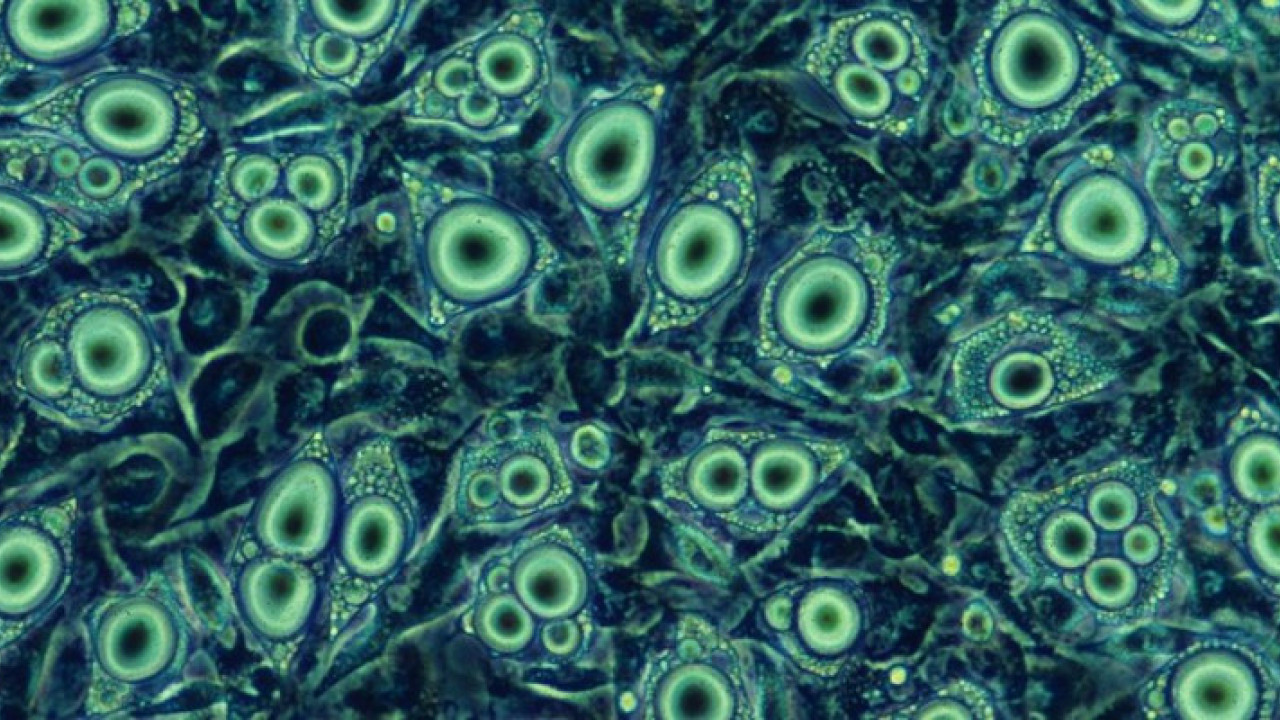 Bio