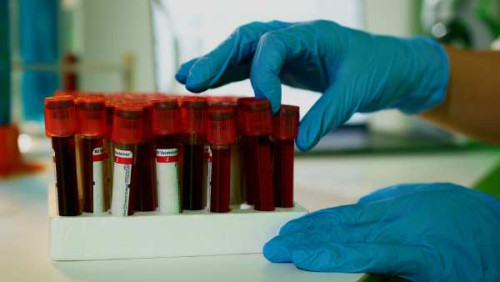 Tubos de sangre